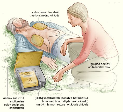 Hvordan bruke en defibrillator