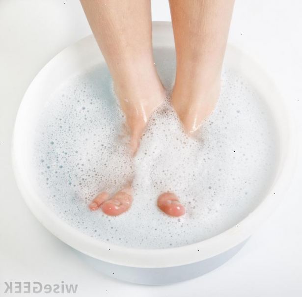 Hvordan å suge en inngrodd tånegl. Lære fordelene av soaking en inngrodd tånegl.