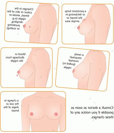 Hvordan vite om du har brystkreft. Utfør en self-eksamen.