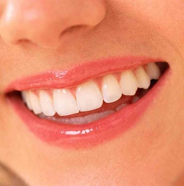 Hvordan har rene, hvite tenner. Skyll munnen med kaldt vann i ca 30 sekunder for å bli kvitt alle løse rusk mellom tennene.