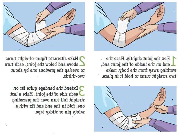 Hvordan bruke forskjellige typer bandasjer. Prøv å vurdere alvorlighetsgraden av såret.